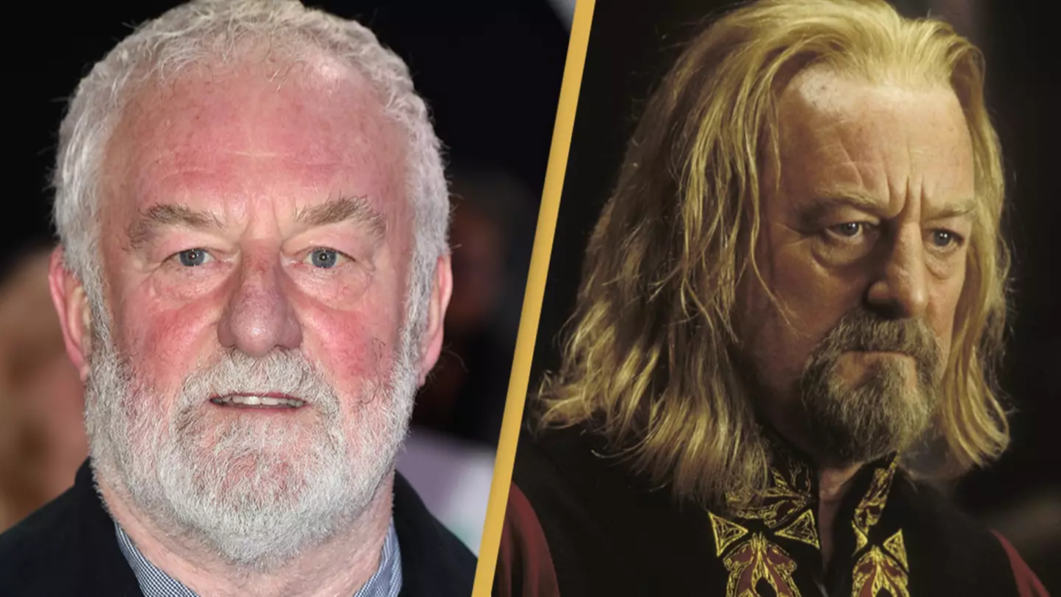 Renowned Actor Bernard Hill Passes Away at 79