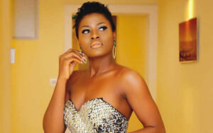 Alex Unusual: From Bullied Teen to Resilient Star