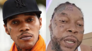 Vybz Kartel Reveals Graves' Disease Battle Behind Facial Changes